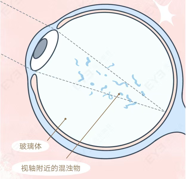 图片.png 图片.png