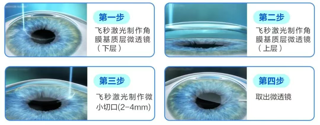 图片.png 图片.png